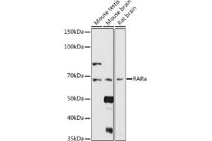 Western blot analysis of extracts of various cell lines, using RARα antibody (ABIN6128615, ABIN6146692, ABIN6146695 and ABIN6213825) at 1:1000 dilution. (Retinoic Acid Receptor alpha antibody  (AA 1-457))