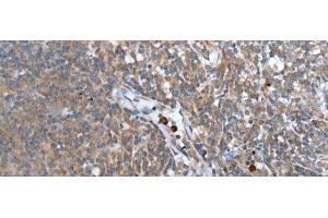 Immunohistochemistry of paraffin-embedded Human tonsil tissue using WISP2 Polyclonal Antibody at dilution of 1:45(x200) (WISP2 antibody)