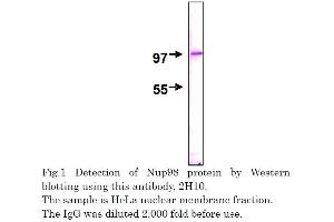 Western Blotting (WB) image for anti-Nucleoporin 98kDa (NUP98) (AA 1-466) antibody (ABIN2452066)