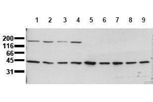 Western Blotting (WB) image for anti-Mitogen-Activated Protein Kinase Kinase 1 (MAP2K1) antibody (ABIN126835) (MEK1 antibody)