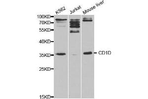 Western blot analysis of extracts of various cell lines, using CD1D antibody. (CD1d antibody  (AA 20-190))