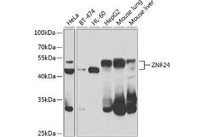 Western blot analysis of extracts of various cell lines, using ZNF24 antibody  at 1:1000 dilution. (ZNF24 antibody  (AA 169-368))
