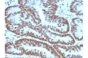 Immunohistochemistry (IHC) image for anti-BMI1 Polycomb Ring Finger Oncogene (BMI1) (AA 142-326) antibody (ABIN6940582)