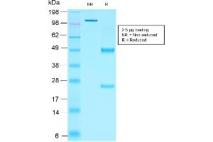 SDS-PAGE Analysis Purified NKX2. (Recombinant Nkx2-2 antibody  (AA 1-119))