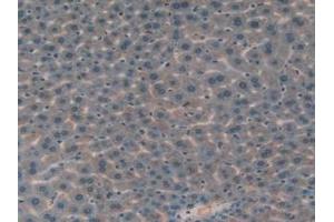 Detection of IGFBP7 in Mouse Liver Tissue using Polyclonal Antibody to Insulin Like Growth Factor Binding Protein 7 (IGFBP7) (IGFBP7 antibody  (AA 88-281))