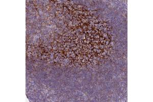 Immunohistochemical staining (Formalin-fixed paraffin-embedded sections) of human tonsil with CR1 polyclonal antibody  shows distinct reticular positivity in germinal center. (CD35 antibody  (AA 278-334))