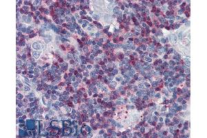 Immunohistochemistry staining of human thymus (paraffin sections) with anti-SLP76 polyclonal. (LCP2 antibody  (AA 216-434))