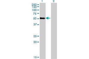Western Blot analysis of ZNF232 expression in transfected 293T cell line by ZNF232 monoclonal antibody (M06), clone 1F8. (ZNF232 antibody  (AA 181-280))