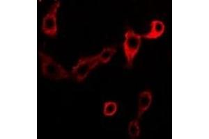 Immunofluorescent analysis of Adenosine Deaminase staining in Jurkat cells. (ADA antibody)
