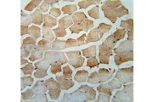 Immunohistochemistry analysis in human skeletal muscle (Formalin-fixed, Paraffin-embedded) using SRBD1  Antibody  (C-term), followed by peroxidase conjugation of the secondary antibody and DAB staining. (SRBD1 antibody  (C-Term))