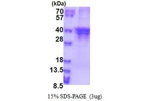 ST3 beta-Galactoside alpha-2,3-Sialyltransferase 5 (ST3GAL5) (AA 83-418) protein (His tag)