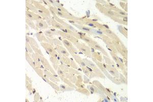 Immunohistochemistry of paraffin-embedded mouse heart using PSME1 antibody (ABIN5973094) at dilution of 1/100 (40x lens). (PSME1 antibody)