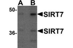 Western blot analysis of SIRT7 in 293 cell lysate with SIRT7 antibody at (A) 0. (SIRT7 antibody  (N-Term))