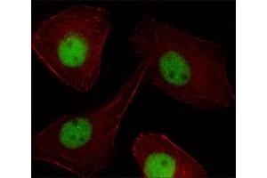 Fluorescent image of U251 cell stained with PR antibody at 1:25. (Progesterone Receptor antibody  (AA 816-843))