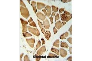 5NT1A Antibody (N-term) (ABIN653871 and ABIN2843123) IHC analysis in formalin fixed and paraffin embedded skeletal muscle followed by peroxidase conjugation of the secondary antibody and DAB staining. (NT5C1A antibody  (N-Term))