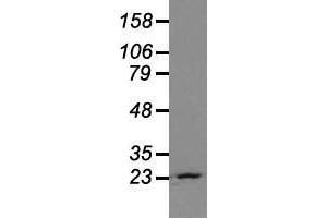 Western blot analysis of extracts (35 µg) from 9 different cell lines by using anti-NEUROG1 monoclonal antibody. (Neurogenin 1 antibody)
