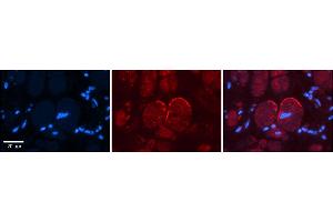 Rabbit Anti-GRIN2C Antibody    Formalin Fixed Paraffin Embedded Tissue: Human Adult heart  Observed Staining: Membrane Primary Antibody Concentration: 1:100 Secondary Antibody: Donkey anti-Rabbit-Cy2/3 Secondary Antibody Concentration: 1:200 Magnification: 20X Exposure Time: 0. (GRIN2C antibody  (N-Term))