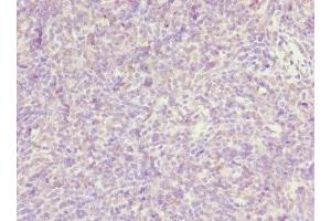 Immunohistochemistry of paraffin-embedded human thymus tissue using ABIN7162470 at dilution of 1:100 (TP53AIP1 antibody  (AA 1-108))