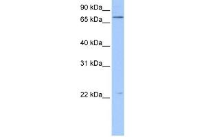 BFSP1 antibody used at 0.