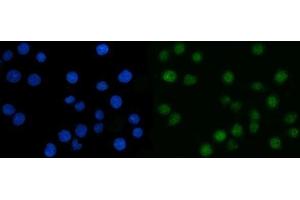 IF analysis of CSNK2A2 using anti-CSNK2A2 antibody (ABIN7602871). (CSNK2A2 antibody  (C-Term))