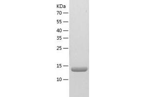 Western Blotting (WB) image for Nucleoside diphosphate kinase B (NME2) (AA 1-152) protein (His tag) (ABIN7285673) (NME2 Protein (AA 1-152) (His tag))