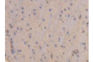 IHC-P analysis of Rat Brain Tissue, with DAB staining. (Peroxiredoxin 6 antibody  (AA 1-224))
