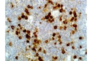 Immunohistochemical staining (Formalin-fixed paraffin-embedded sections) of human tonsil with Human Ig lambda light chain monoclonal antibody, clone RM127 (Biotin) .
