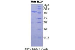 SDS-PAGE (SDS) image for Interleukin 24 (IL24) (AA 29-183) protein (His tag,GST tag) (ABIN1877608) (IL-24 Protein (AA 29-183) (His tag,GST tag))