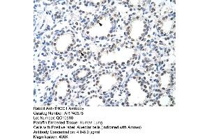 Rabbit Anti-THOC1 Antibody  Paraffin Embedded Tissue: Human Lung Cellular Data: Alveolar cells Antibody Concentration: 4. (THOC1 antibody  (C-Term))