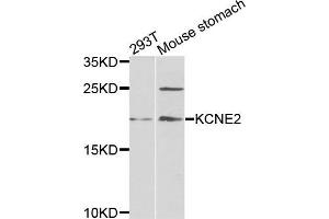 Western blot analysis of extracts of 293T and mouse stomach cells, using KCNE2 antibody. (KCNE2 antibody)