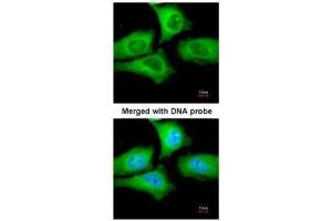 Immunofluorescence (IF) image for anti-Chaperonin Containing TCP1, Subunit 5 (Epsilon) (CCT5) antibody (ABIN2856739)