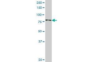 RPS6KA3 monoclonal antibody (M01), clone 2G10. (RPS6KA3 antibody  (AA 2-95))