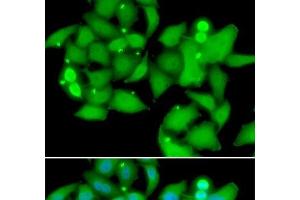 Immunofluorescence analysis of A549 cells using UBASH3B Polyclonal Antibody