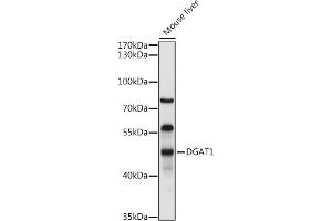 Western Blotting (WB) image for anti-Diacylglycerol O-Acyltransferase 1 (DGAT1) (AA 200-300) antibody (ABIN6139556)