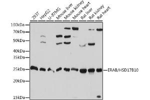 Western blot analysis of extracts of various cell lines, using ERAB/HSD17B10 Rabbit mAb (ABIN1513420, ABIN3021162, ABIN3021163 and ABIN7101350) at 1:1000 dilution. (HSD17B10 antibody)