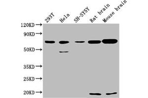 Western Blot Positive WB detected in: 293T whole cell lysate, Hela whole cell lysate, SH-SY5Y whole cell lysate, Rat Brain tissue, Mouse Brain tissue All lanes: WASF1 antibody at 1:2000 Secondary Goat polyclonal to rabbit IgG at 1/50000 dilution Predicted band size: 62 kDa Observed band size: 72 kDa (WASF1 antibody  (AA 381-553))