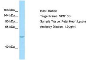 Image no. 1 for anti-Vacuolar Protein Sorting 13 Homolog B (Yeast) (VPS13B) (AA 76-125) antibody (ABIN6749989) (VPS13B antibody  (AA 76-125))