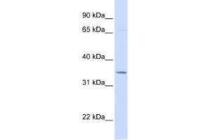 TOLLIP antibody used at 1 ug/ml to detect target protein. (TOLLIP antibody  (C-Term))