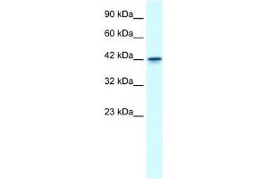 Human Jurkat; WB Suggested Anti-GFI1B Antibody Titration: 0.