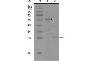 Western Blot showing PGR antibody used against truncated MBP-PGR recombinant protein (1) and truncated Trx-PGR (aa730-871) recombinant protein (2). (Progesterone Receptor antibody  (AA 730-871))