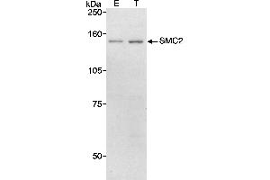 Western Blotting (WB) image for anti-Structural Maintenance of Chromosomes 2 (SMC2) (AA 50-100) antibody (ABIN7449269)