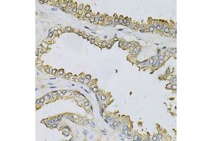 Immunohistochemistry of paraffin-embedded human prostate using APRT Antibody (ABIN6291536) at dilution of 1:100 (40x lens). (APRT antibody)