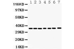 Anti- Annexin A3 Picoband antibody, Western blotting All lanes: Anti Annexin A3  at 0. (Annexin A3 antibody  (Middle Region))