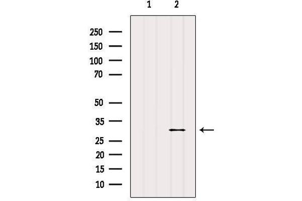 E2F6 antibody  (Internal Region)