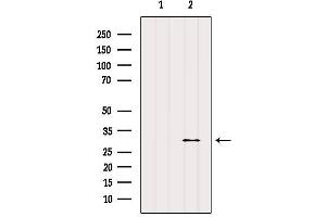 Western blot analysis of extracts from Mouse muscle, using E2F6 Antibody. (E2F6 antibody  (Internal Region))