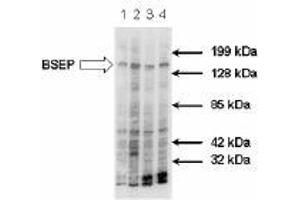 Image no. 1 for anti-ATP-Binding Cassette, Sub-Family B (MDR/TAP), Member 11 (ABCB11) antibody (ABIN187437) (ABCB11 antibody)