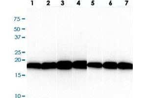 Western blot analysis of (1) HepG2, (2) HeLa, (3) Raji, (4) Jurkat, (5) A549, (6) MCF7, (7) PC3 cell lysate. (VHL antibody  (AA 1-154))