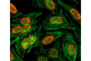 ICC/IF test of HeLa cells treated with sodium butyrate using recombinant H3K9me2 antibody (red). (Recombinant Histone 3 antibody  (H3K9me2))