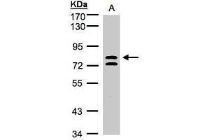 WB Image Sample(30 ug whole cell lysate) A:HeLa S3, 7. (L3MBTL1 antibody  (Center))
