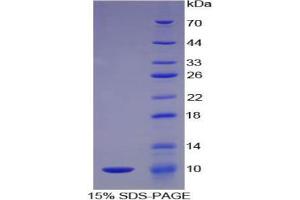 SDS-PAGE analysis of Mouse C5a Protein.